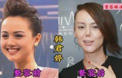 聊聊那些被整容坑惨的女星，你觉得谁最可惜？缩略图