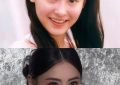 张上了医美是让人美这条路，真是让人意外啊缩略图