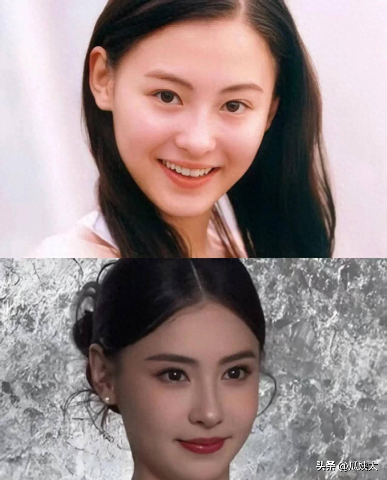 张上了医美是让人美这条路，真是让人意外啊插图